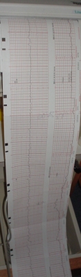 Laura & Nate's heart monitor.